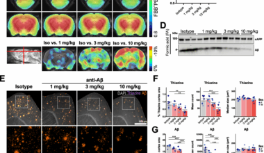 Early intervention anti-Aβ immunotherapy attenuates microglial activation without inducing exhaustion at residual plaques | Molecular Neurodegeneration