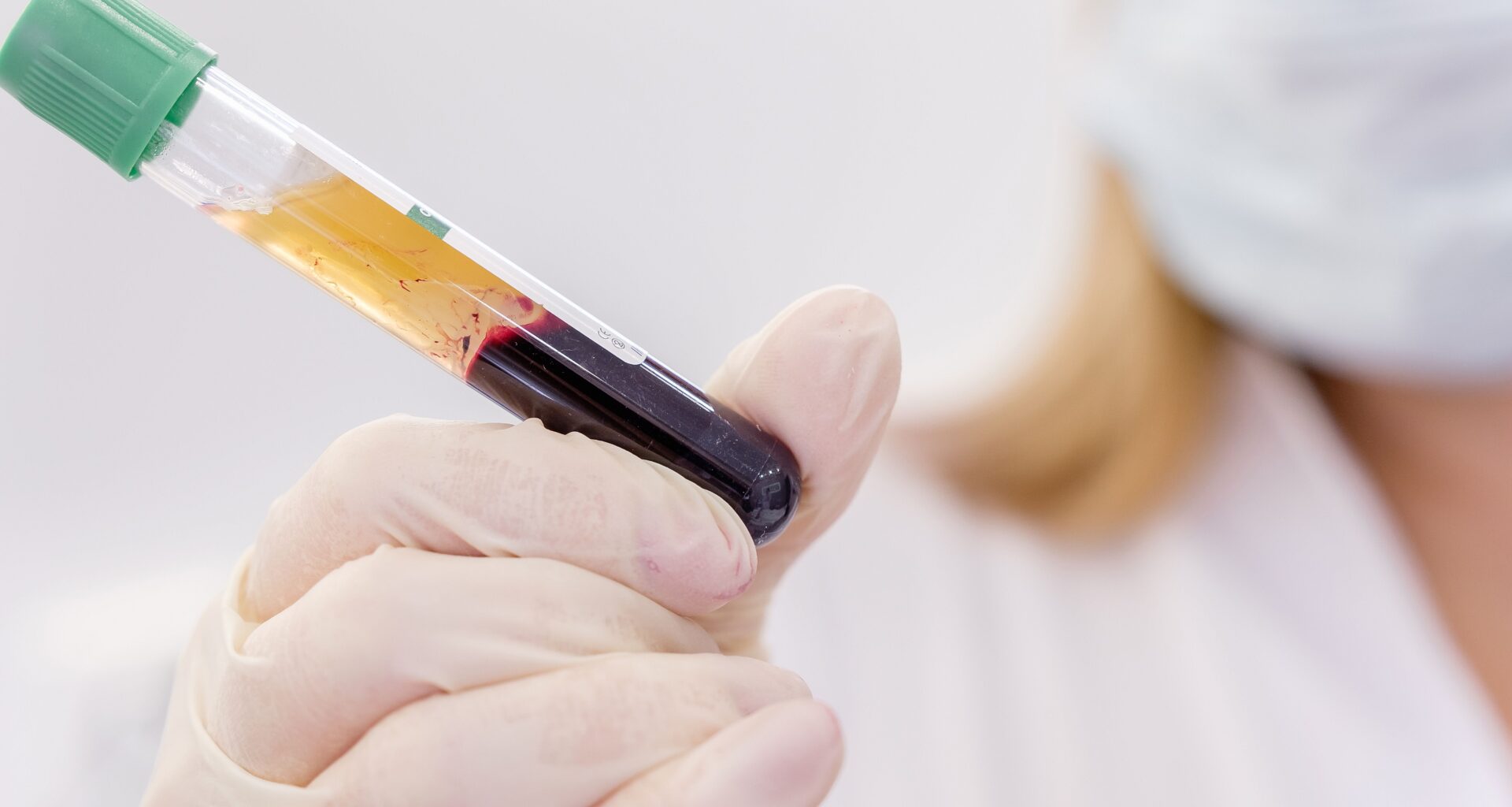 Regenerative plasma therapy now available for US veterinary practices