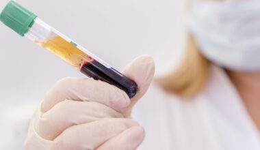 Regenerative plasma therapy now available for US veterinary practices