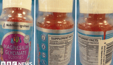 Warning issued over kids' magnesium supplement gummies