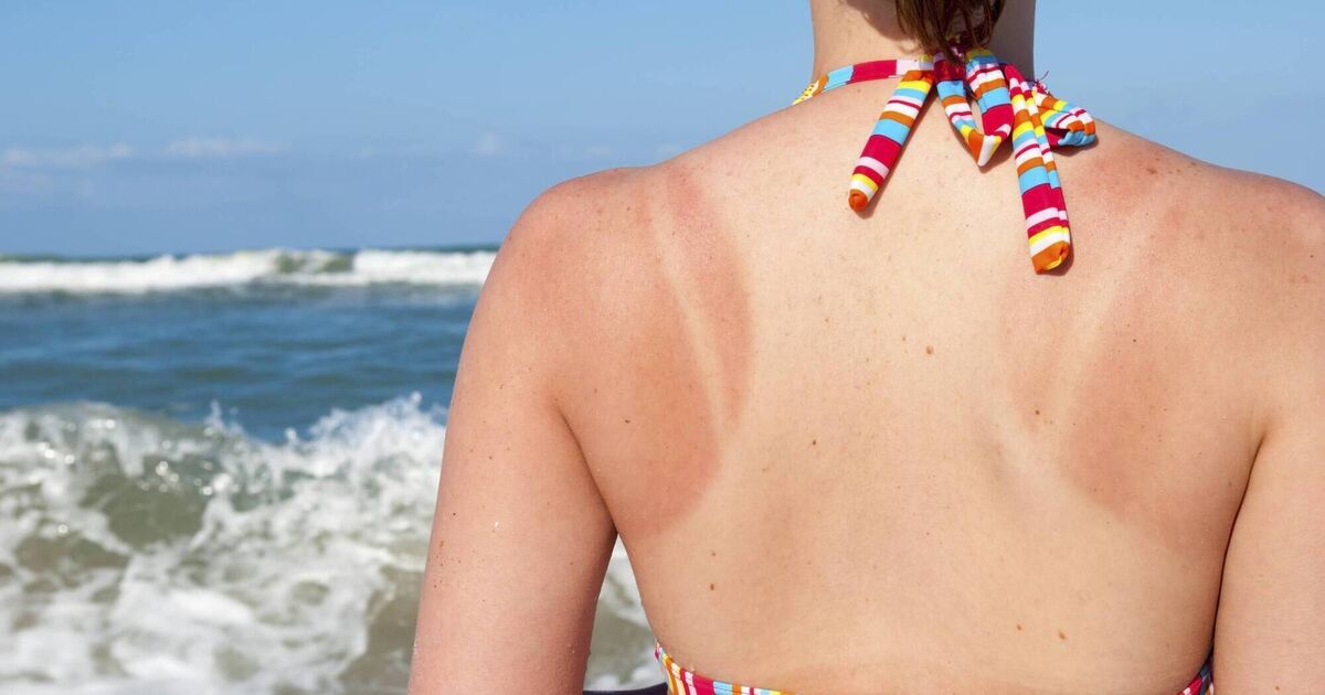 How to reverse signs of sun damage