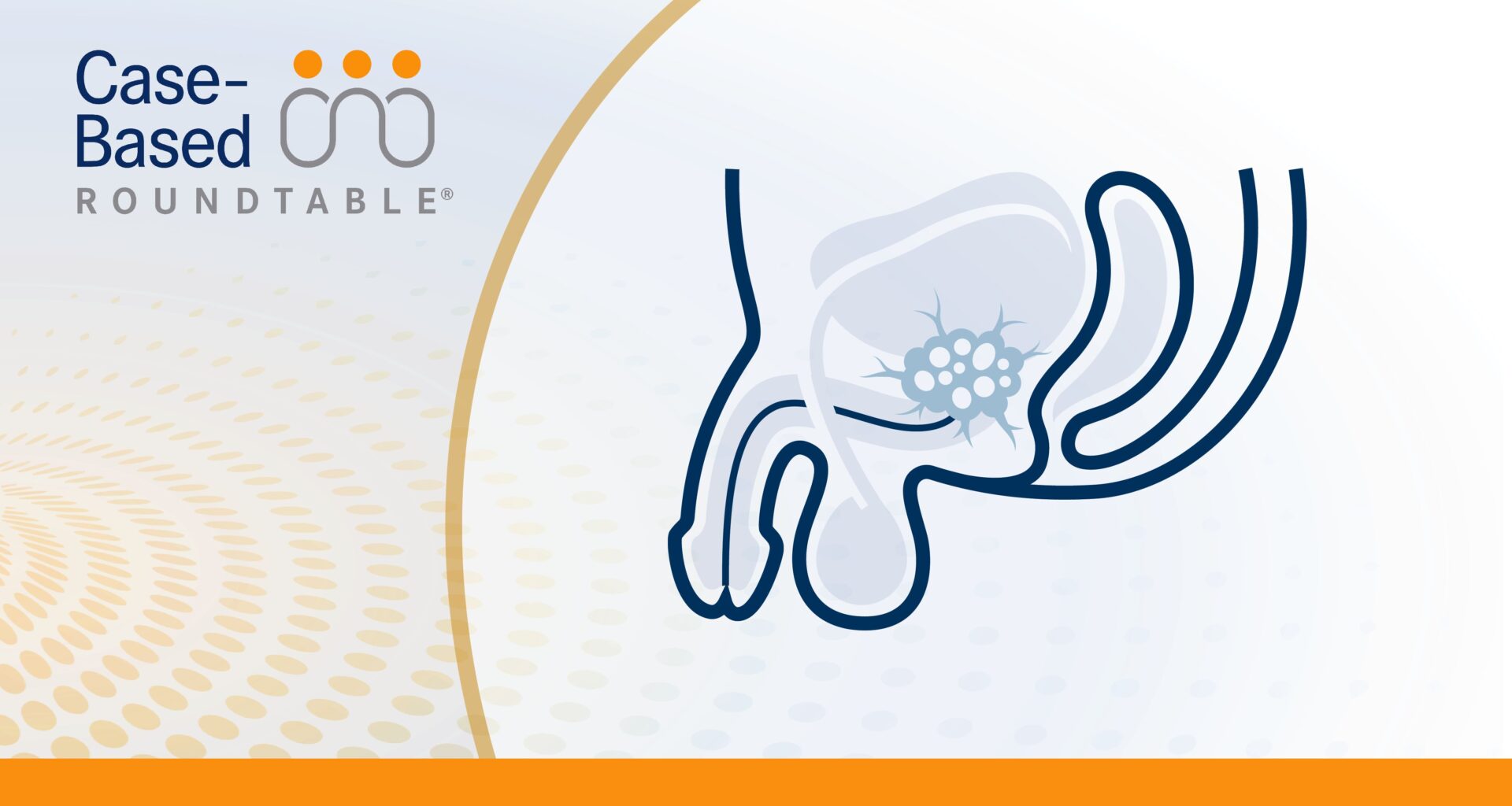 Applying Recent Trial Data to mHSPC Clinical Decision-Making