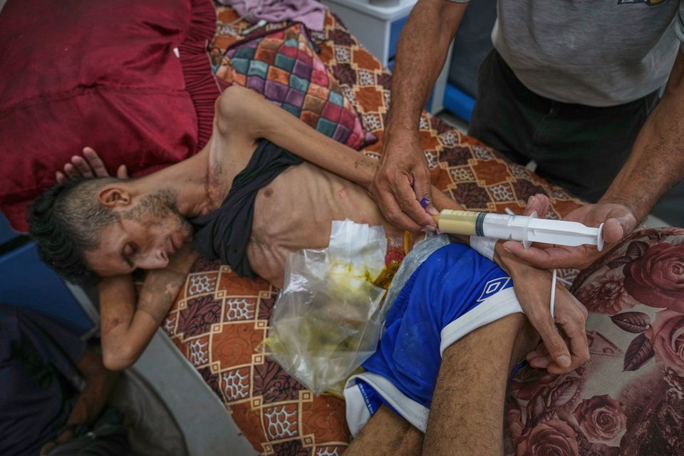 Karam Arhouma (22) is fed lentil soup through a syringe at Shifa Hospital in Gaza City. Photo: AP/Abdel Kareem Hana