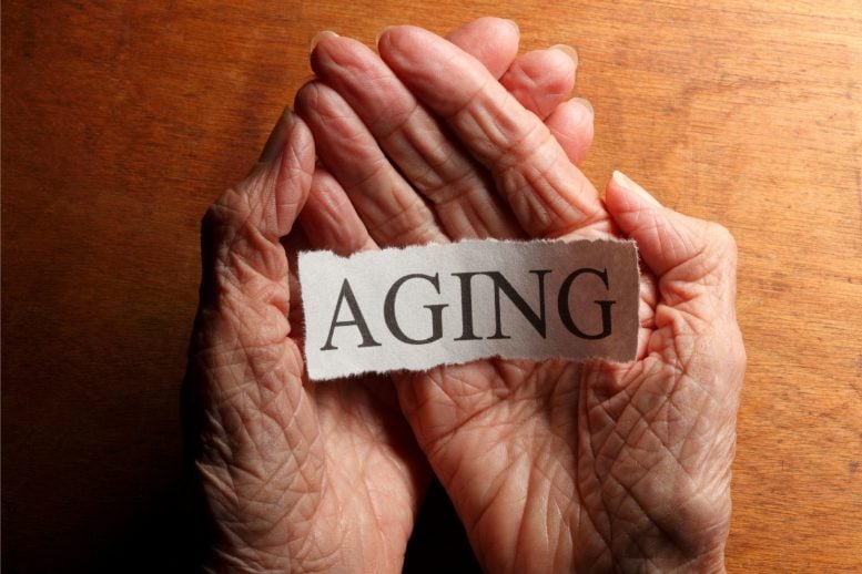 Aging Hands