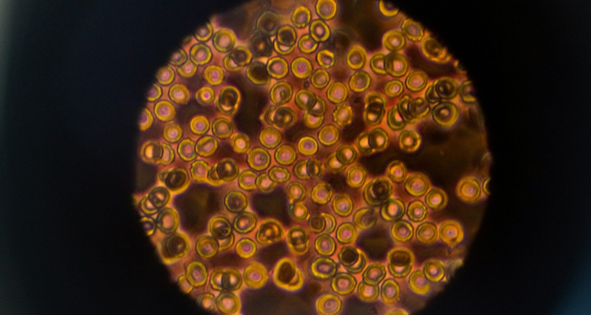 New microscope tech could give the deepest looks yet into living brain tissue