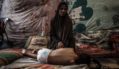 Doctors in Gaza struggle to fight rare paralytic illness under Israeli blockade – POLITICO