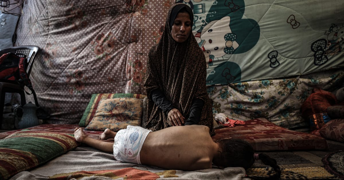 Doctors in Gaza struggle to fight rare paralytic illness under Israeli blockade – POLITICO