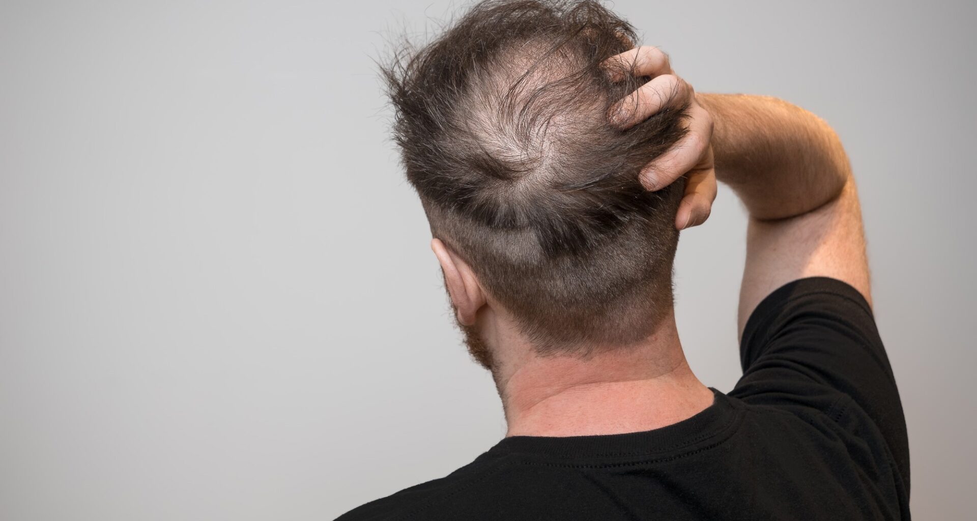 Assessing the relationship between dietary factors and hair health: A systematic review. Image Credit: Chris Curry / Shutterstock