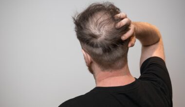 Assessing the relationship between dietary factors and hair health: A systematic review. Image Credit: Chris Curry / Shutterstock