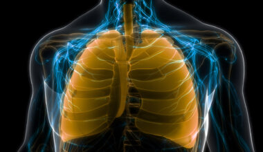 Genetic analysis of people with African ancestry reveals lung cancer susceptibilities  