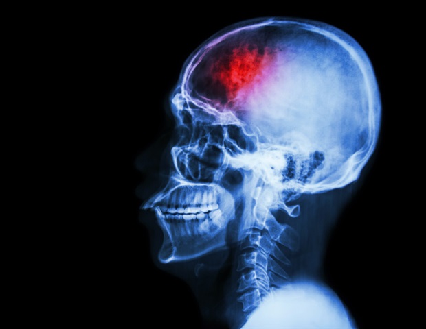 Groundbreaking approach combines 3D printing and stem cell biology for spinal cord injury recovery