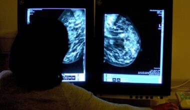 AI just as accurate as radiologists at detecting breast cancer, study finds – The Irish Times