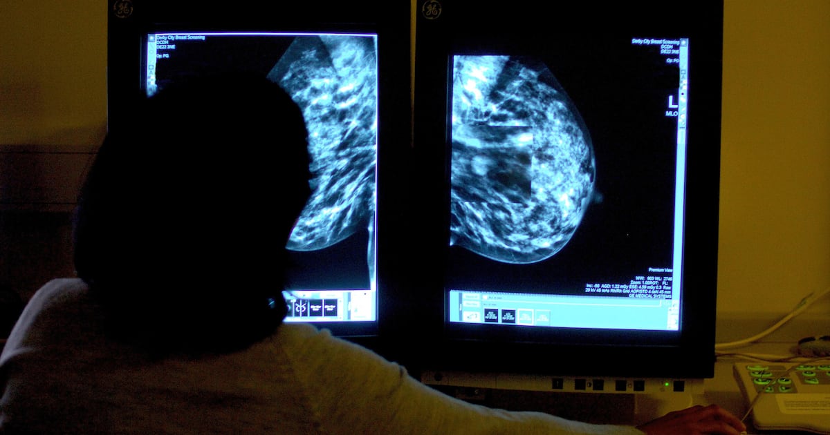AI just as accurate as radiologists at detecting breast cancer, study finds – The Irish Times