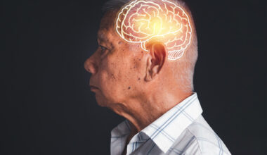 Old Asian Man Dementia Alzheimer