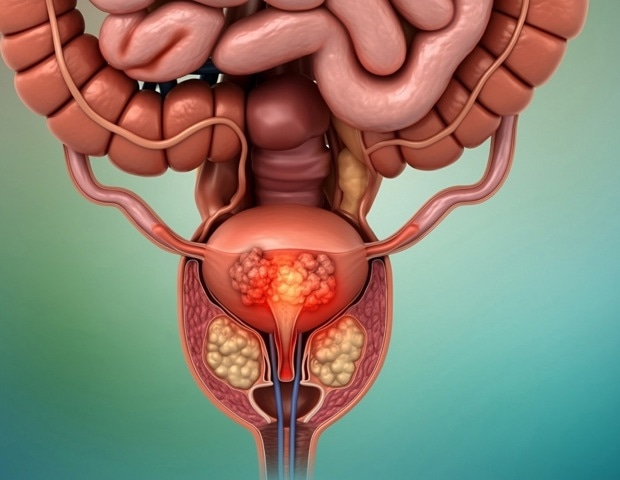 New 'dual-mode' tracer agent enhances precision in prostate cancer procedures