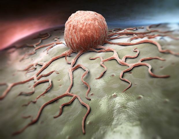 Tumor microbiota identified as predictors of prognosis in gastrointestinal cancers