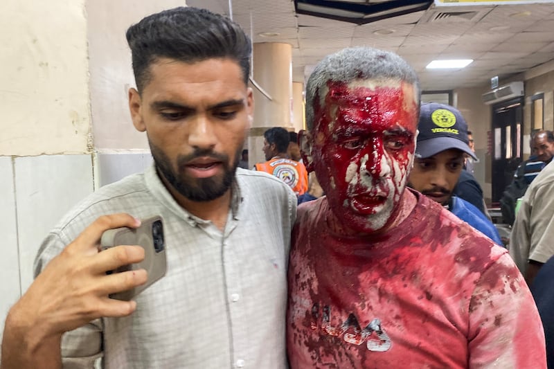 Palestinians help Reuters photographer Hatem Omar, who was injured in Israeli strikes on Nasser hospital in Khan Yunis in the southern Gaza Strip. Photograph: AFP via Getty Images          