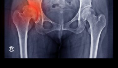 Assessments of children who may have had unnecessary hip surgeries pushed back to next year – The Irish Times