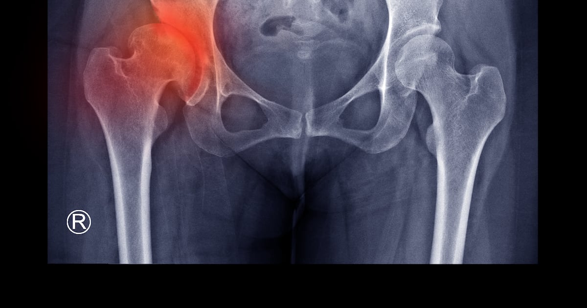 Assessments of children who may have had unnecessary hip surgeries pushed back to next year – The Irish Times