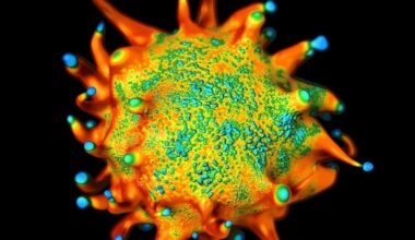 Cervical Cancer, Hodgkin Lymphoma Increase ASCVD Risk