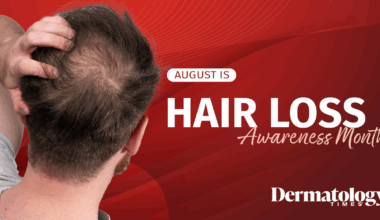 Celebrating Hair Loss Awareness Month 2025 with Dermatology Times