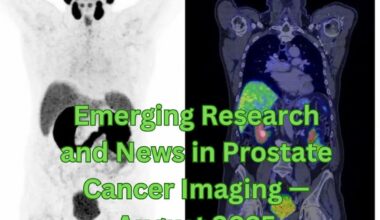 Emerging Research and News in Prostate Cancer Imaging — August 2025