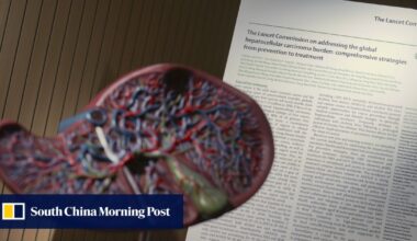 Lifestyle fixes can curb doubling of liver cancer cases by 2050: Hong Kong experts