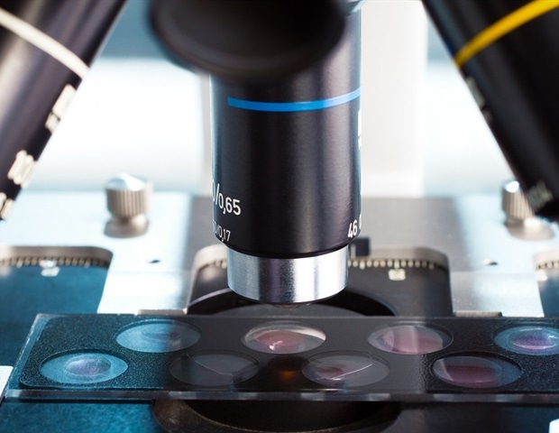 Innovative cryo-microscopy offers precise views of rapid cell activity