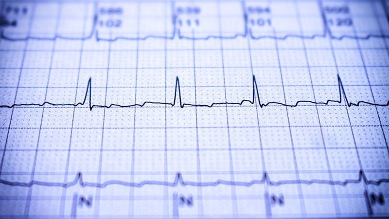 Smartphone App May Simplify Screening of AF in Communities