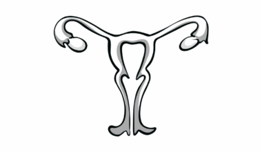 Study Reveals Missed Opportunities for Surgical Prevention of Ovarian Cancer