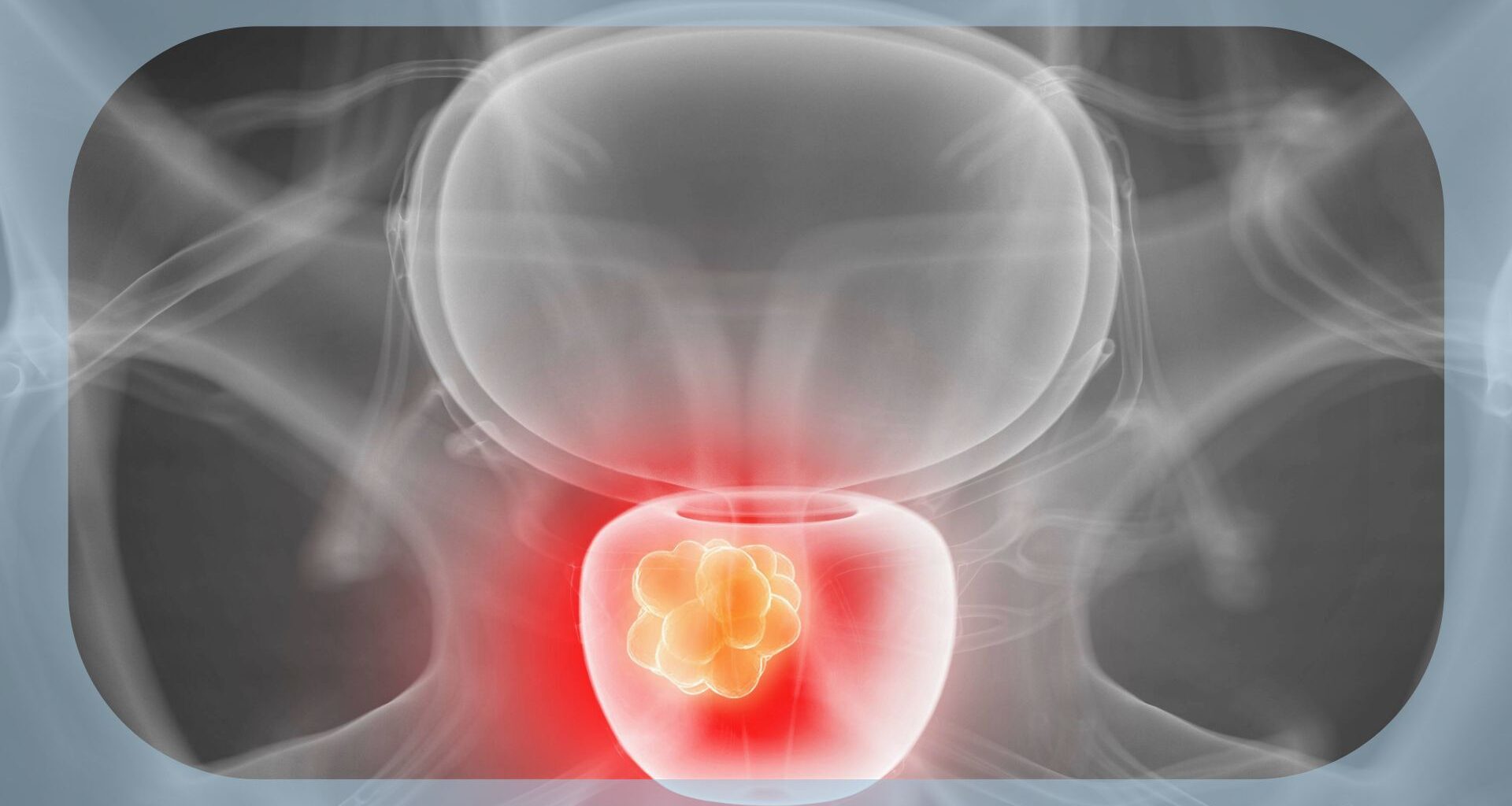 Observational Study Associates BRCA and Other HRR Gene Alterations With Poorer Outcomes in mHSPC