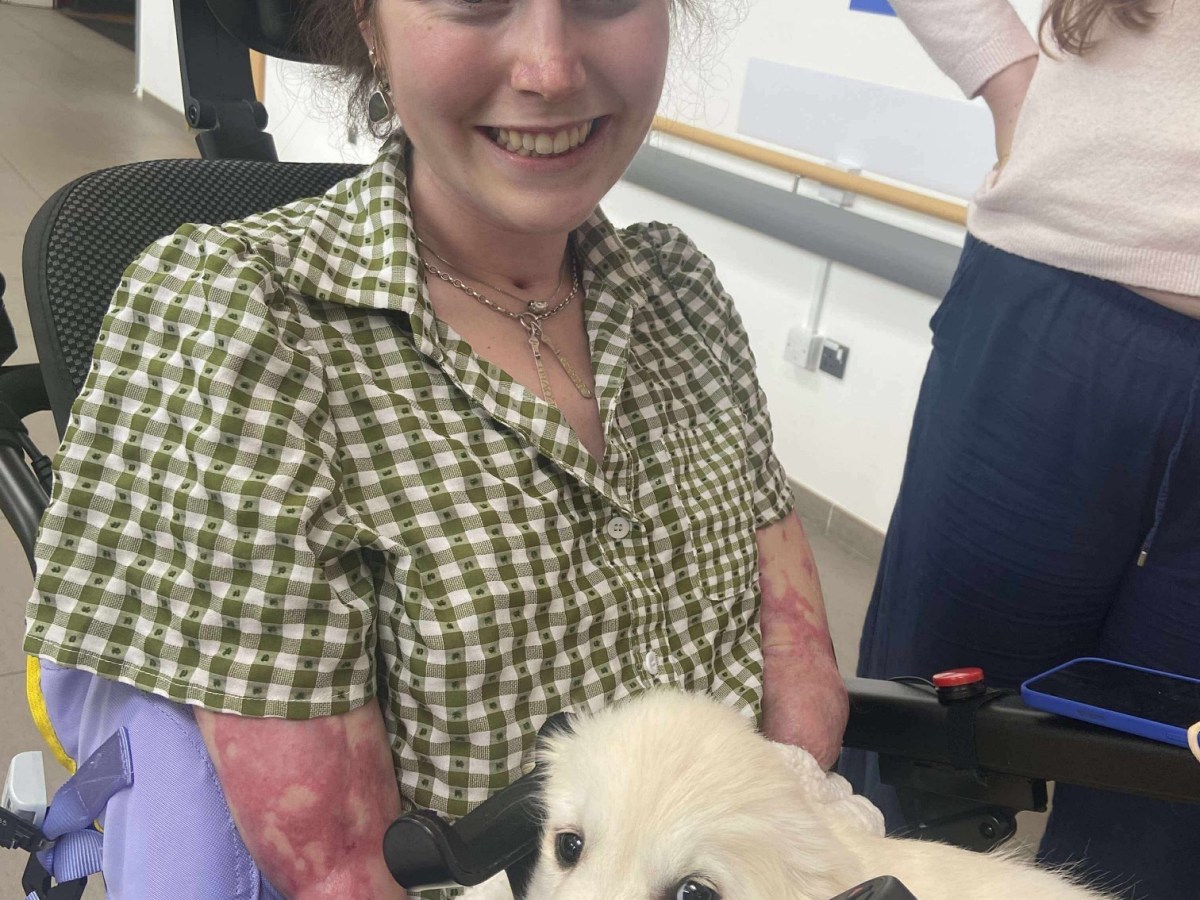 Jersey-born quadruple amputee makes “milestone” move to rehab centre