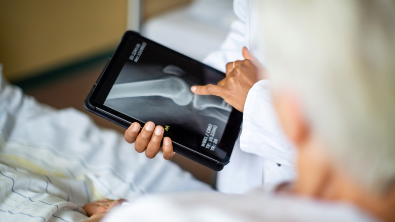 doctor pointing at bone x-ray