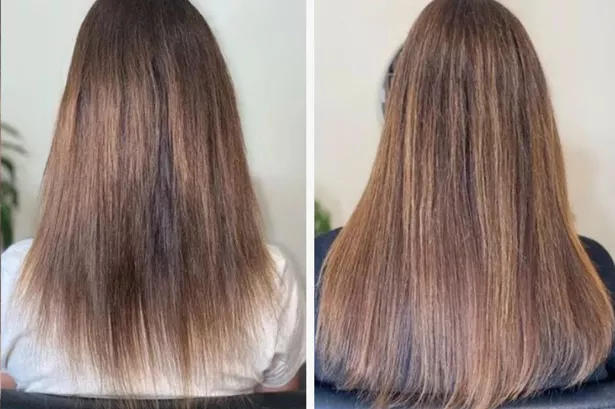 'I never thought I would ever get my hair back to a good condition,' said Emma who used Hair Saviour