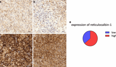 Reticulocalbin-1 in clear cell renal cell carcinoma: clinical and functional evidence for its role as a biomarker and potential therapeutic target | BMC Cancer