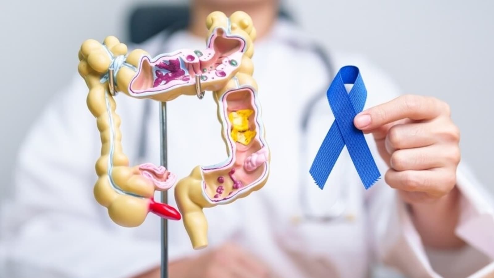 Harvard gastroenterologist shares 8 colon cancer warnings you should never ignore: Constipation, diarrhoea | Health