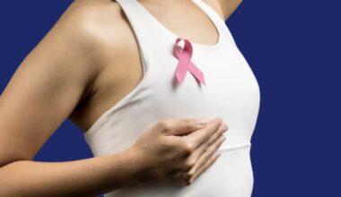 Breast cancer surgeon warns ‘breast cancer doesn’t always come with lump’: Nipple discharge, swelling can be signs