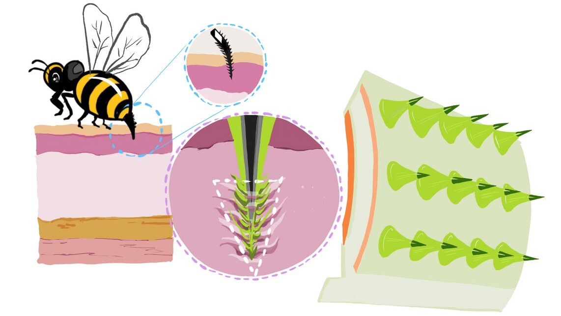 Bee Stingers Inspire Superior and Comfortable Continuous Drug Delivery