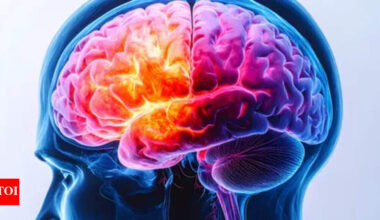 With Alzheimer’s rising, docs call for early diagnoses, social interaction | Goa News