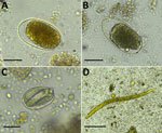 Light microscopy images of soil-transmitted helminths from human stool samples, Gabon. A, B) Hookworm eggs; scale bars indicate 25 µm. C) Strongyloides spp. eggs; scale bar indicates 25 µm. D) Strongyloides spp. larvae; scale bar indicates 50 µm. Helminths were detected by using the formalin ethyl acetate sedimentation method. Molecular analysis of ethanol-preserved stool sample aliquots from the same patients indicated Necator americanus (A), N. gorillae (B), Strongyloides fuelleborni fuelleborni (C), and S. stercoralis (D).