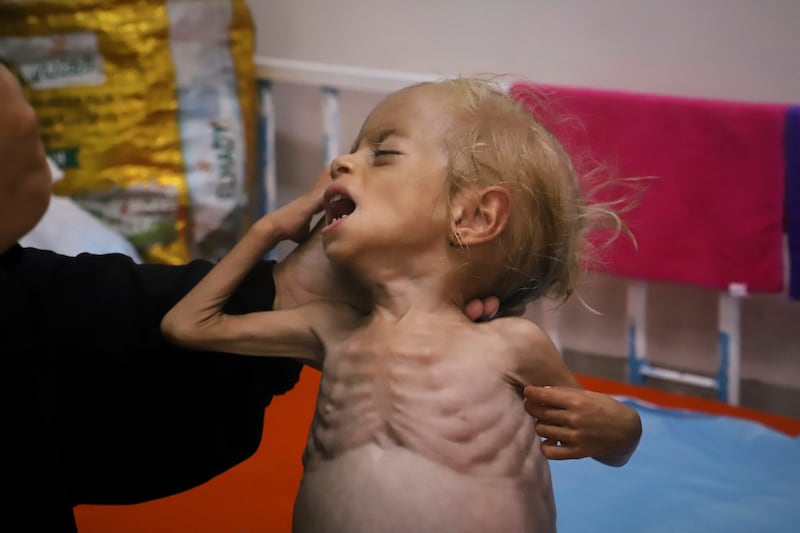 The humanitarian crisis is deepening in Gaza. Photograph: Mariam Dagga/AP