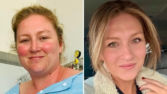 Kate Daniel shares her journey of losing 70 kg, emphasising the importance of mindset and daily habits over perfection.(Instagram/@bariatric_chic)