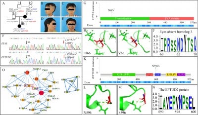 Identification of novel mutations in EYA3 and EFTUD2 in a family with craniofacial microsomia: evidence of digenic inheritance