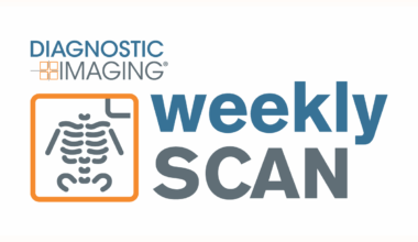Diagnostic Imaging's Weekly Scan: September 21 — September 27 - diagnosticimaging.com