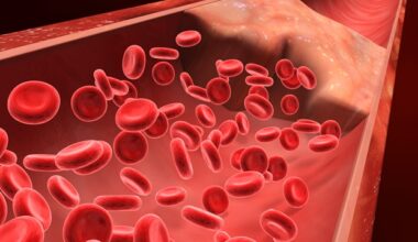 Extended apixaban therapy lowers recurrent VTE in patients with provoked events and enduring risk factors