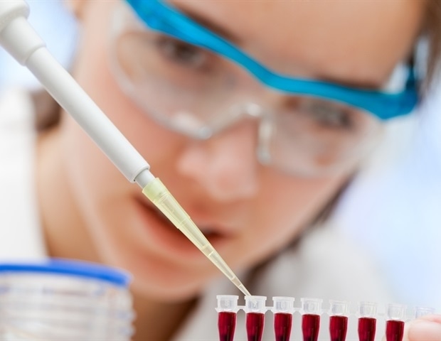 UCL launches landmark trial of Alzheimer’s blood test