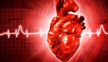 Ivabradine fails to prevent myocardial injury after noncardiac surgery in large clinical trial