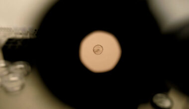 Scientists call for dead end, not guardrails, for embryo gene editing