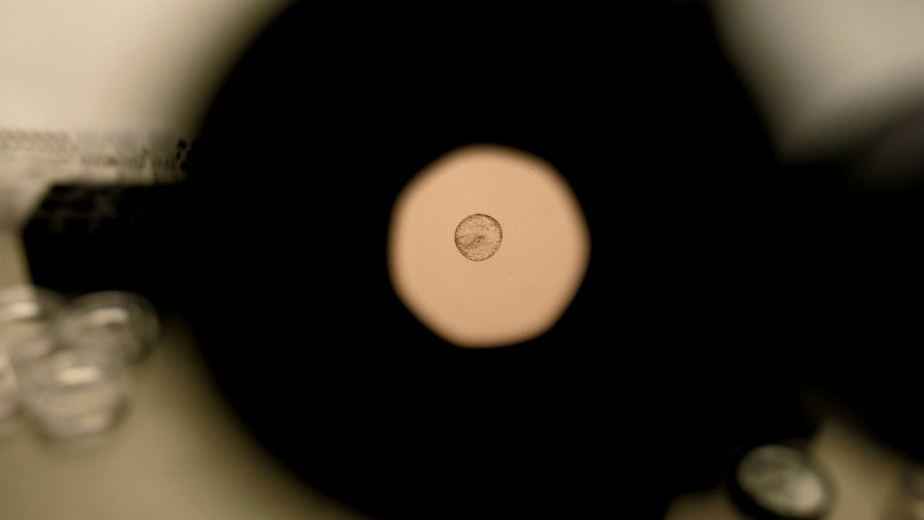 Scientists call for dead end, not guardrails, for embryo gene editing