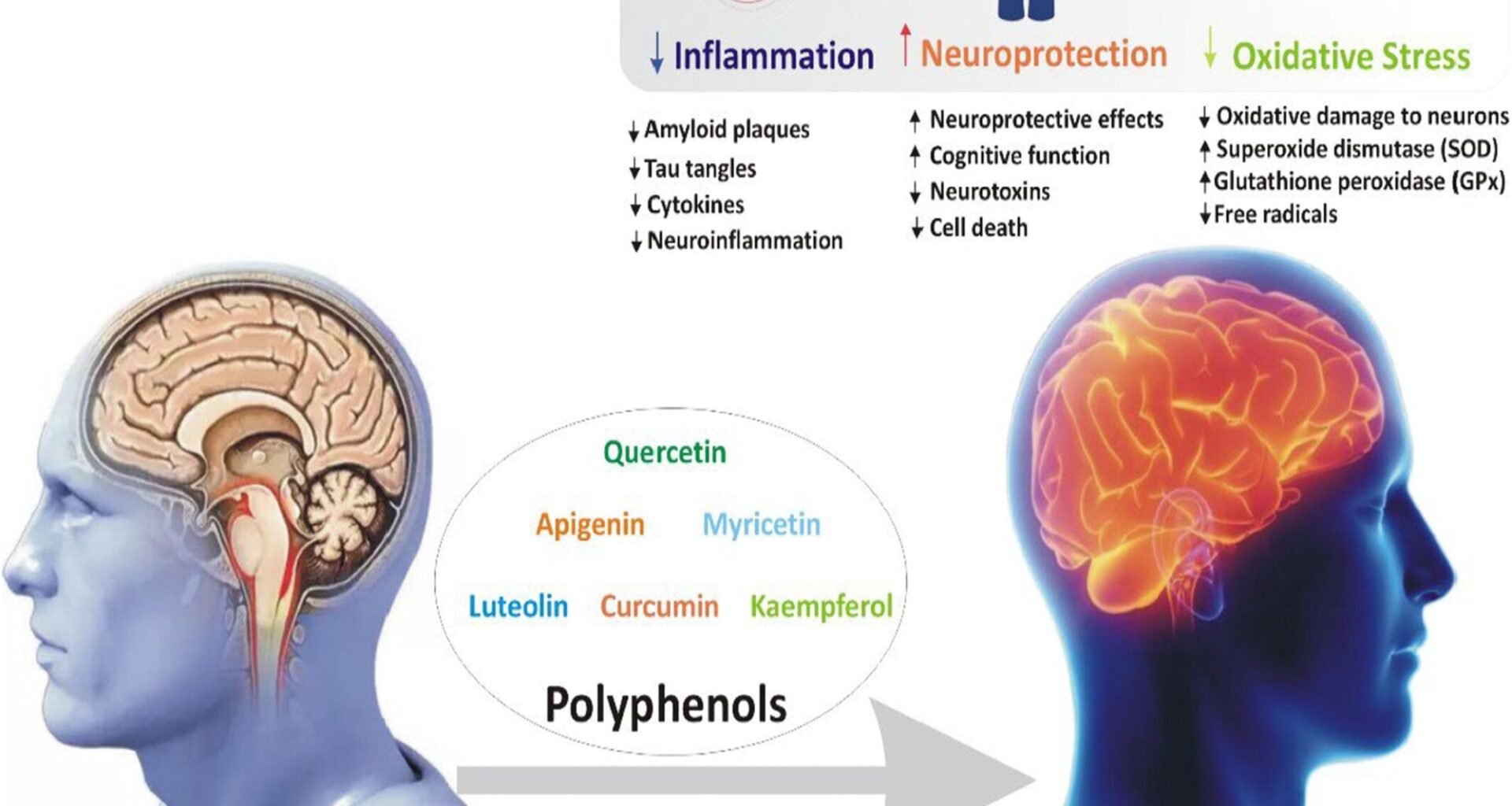 Review: Polyphenols and Alzheimer
